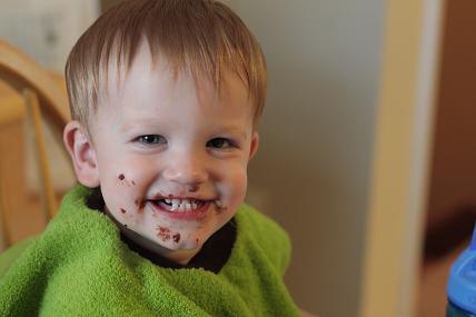 baby with underbite